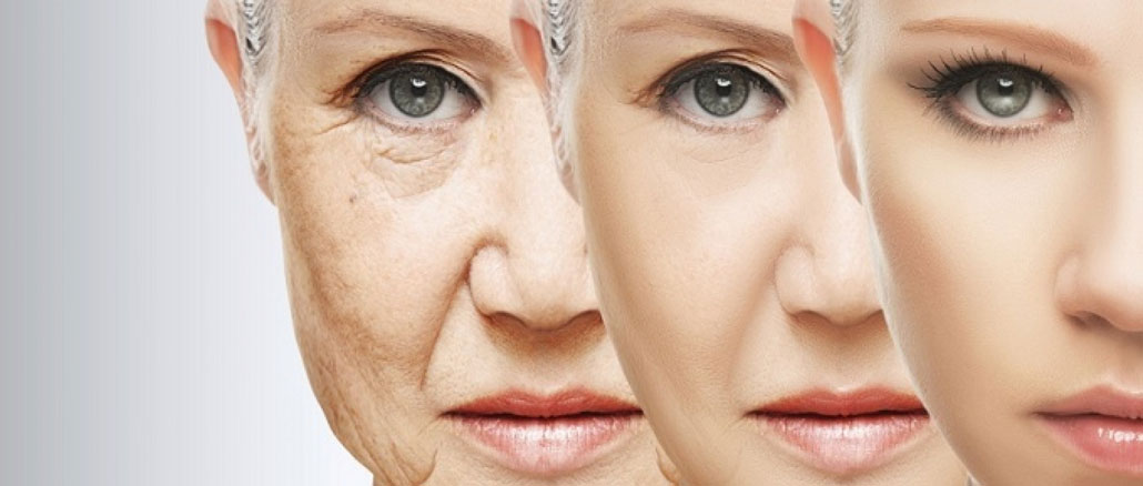 aging-skin