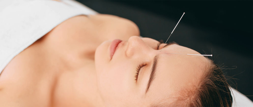 cosmetological-acupuncture