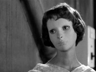 Кадр из фильма “Глаза без лица”