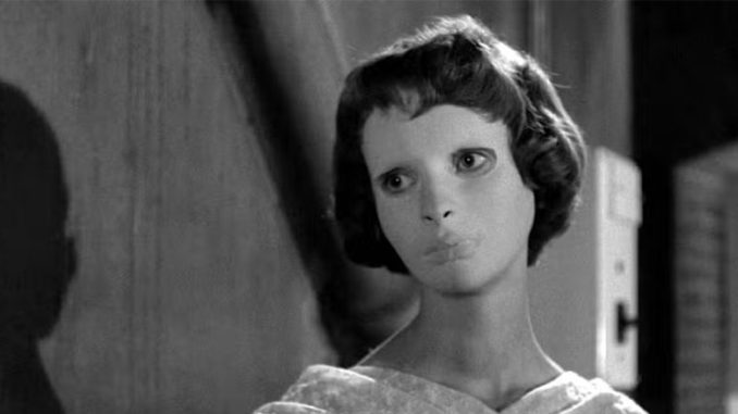 Кадр из фильма “Глаза без лица”